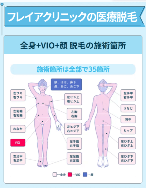 フレイアの脱毛箇所
