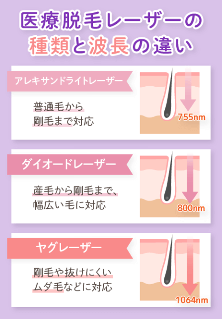 医療脱毛レーザーの種類